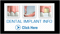 implant_vid