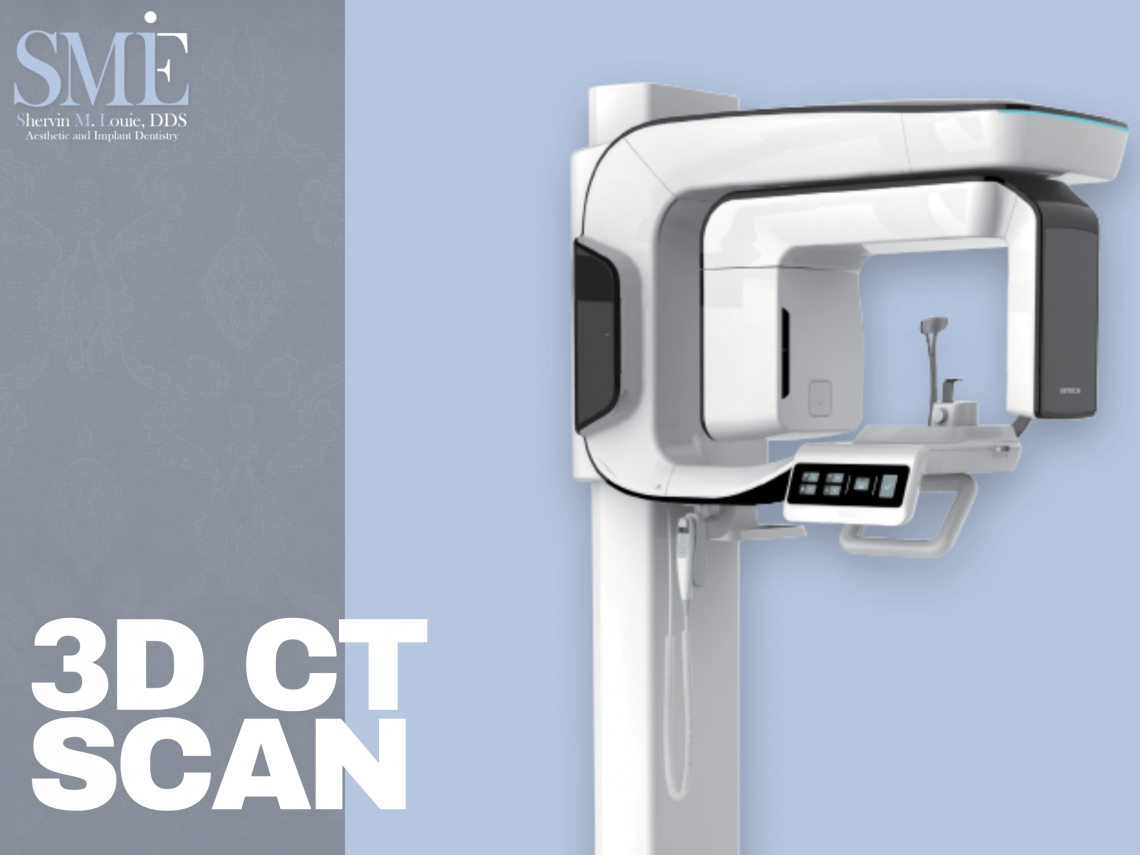 3D CT Scanning Dentist Los Angeles