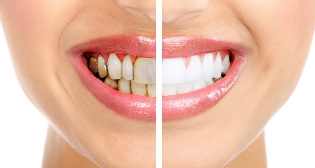 7 Best Tips To Get The Most Beautiful Smile | Shervin M. Louie, DDS